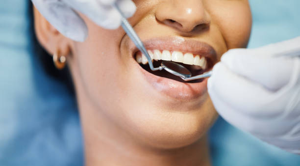 Best Weekend Emergency Dental Services in San Benito, TX